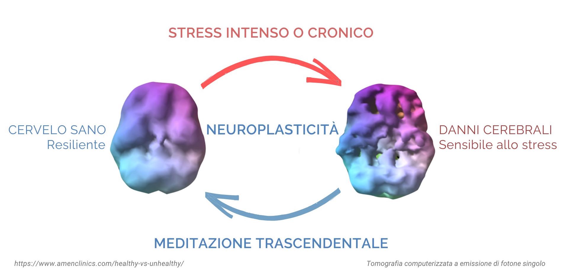 Meditazione Trascendentale e Cervello